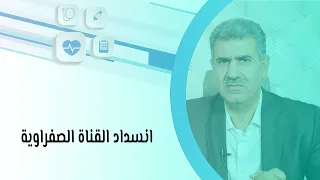 أسباب انسداد القناة الصفراوية وعوارضها والعلاجات المتوفرة 