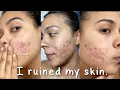 Lagu I Ruined My Skin with this Beauty Hack... #shorts #skincare