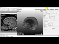 MeVisLab Biomedical Data Visualization and Processing AnalgINO