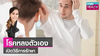 ปัจจัยหลักที่ทำให้เกิดโรคหลงตัวเองมีอะไรบ้าง