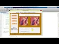 Lossless Image Compression Matlab Project Medical Image Compression Using Matlab