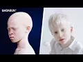 8 Datos sorprendentes de Los Albinos que no sabias