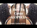 How To Cover Alopecia Step By Step Ms Pk s Crochet Braids Tutorial 4