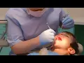 Download Lagu TEETH CHECK UP ❗️❗️❗️| Topsy \u0026 Tim | Cartoons For Kids | WildBrain Kids