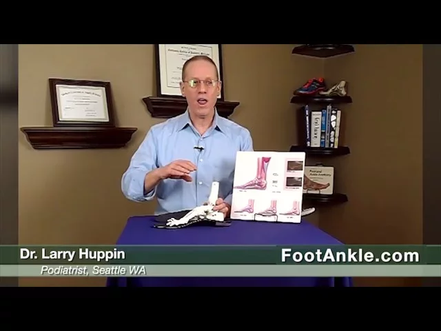 Heel Spur Treatment – How to Avoid Heel Spur Surgery | Seattle Podiatrist