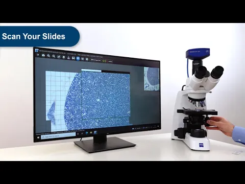 converting a microscope to a digital slide scanner