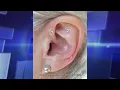 Earrings for Weight Loss