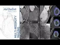 CTA for Assessment of Coronary Anatomy and Physiology Su Min Chang MD December 3 2019