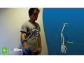 Arm 3D motion analysis with inertial sensors