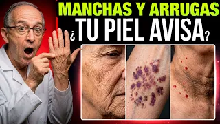 🔴 ARRUGAS, MANCHAS Y PIEL DELGADA: Qué le Pasa a tu Cuerpo y Cómo Solucionarlo?, Oswaldo Restrepo