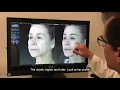 Dr Juan Carlos Fuentes Facelift in Tijuana 3D simulation