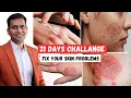 21 Days Challenge Cure Your All Skin Problems - Dr Vivek Joshi