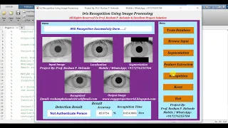 Iris Recognition Using Image Processing Matlab Project Code Final Year Project IEEE Projects