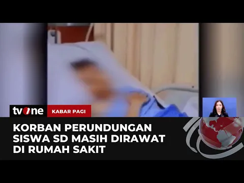 RS Kanker Dharmais Angkat Bicara soal Siswa SD Diamputasi Usai Dirundung
