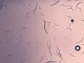 C elegans rol-6 movement