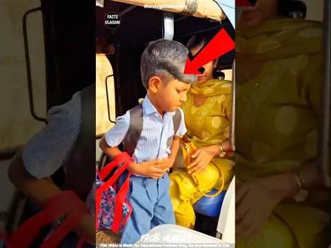 This boy is pretending to have a stomach pain| #factsintamil #factsulagam #short