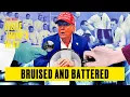 Download Lagu White House Raging at Trump's Health Crisis: Michael Wolff | Inside Trump's Head