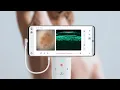 Download Lagu Dermus | Introducing SkinScanner | 2024