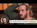 Logan paul shows his enormous forehead