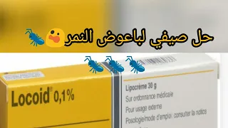 أقوى كريم يساعدك على تخلص من لسعات و اثر ناموس النمر 