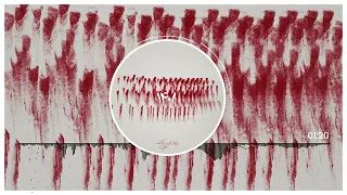                               آهنگ اعتراضی جدید لیتو و سیجل و خلسه به نام      دندنها