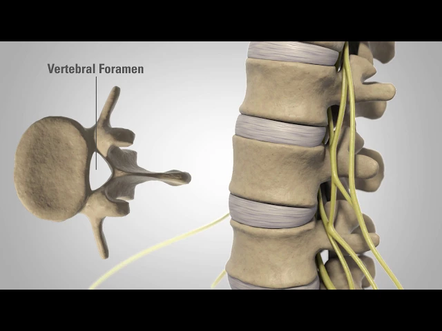 General Back and Neck Pain - Patient Animation