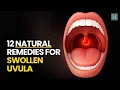 12 Natural Remedies For Swollen Uvula Healthspectra