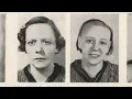 Download Lagu The Insane Lobotomy Craze Of The 1950s