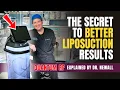 QuantumRF Explained How Dr Newall Enhances Liposuction Body Contouring Results