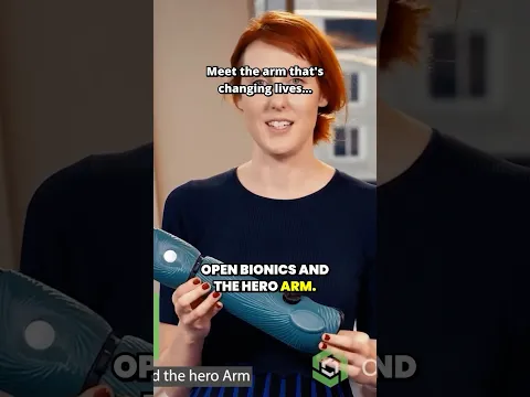 Prosthetics- Hero arm | Medical Appraisals