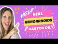 Help Heal Hemorrhoids Naturally with Castor Oil