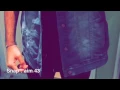 خطوه عبد العزيز الويس مسرعه