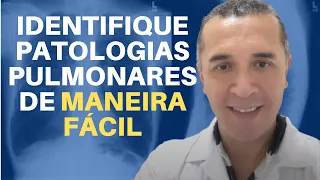 Raio X do Tórax  10 Patologias Mais Comuns