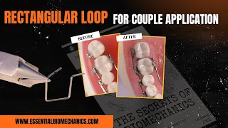 Rectangular - Loop