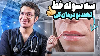 از بین بردن خط خنده با روش های خانگی در کمتر از دو هفته 