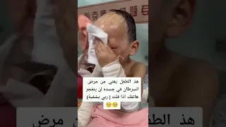 اللهم الشفاء العاجل يارب العالمين انا لله وانا اليه راجعون متابعه لايك اكسبلور Arabic 