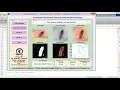 Skin Disease Detection Using Matlab Project Code