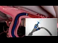 UCI-MIVI Implementation of Real-Time Pulsatile Aspiration Control for Ischemic Stroke Treatment