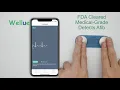 DuoEK Mobile Personal EKG from Wellue