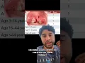 Strep throat or a common cold