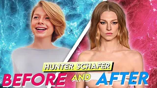 Hunter Schafer Before After Plastic Surgery Transformation