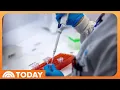 Inside the groundbreaking research to find cancer before it spreads