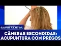 Download Lagu Acupuntura com Pregos | Câmeras Escondidas (07/01/18)
