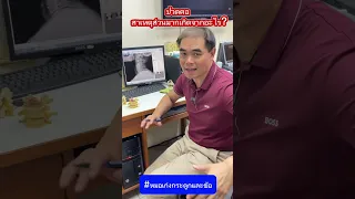  อาการปวดคอ ร้าวไปถึงศีรษะและชาลงแขน เกิดจากสาเหตุอะไร 