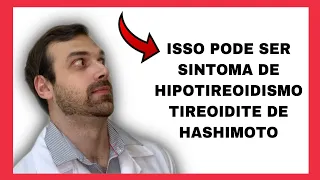 Download Hashimoto's Thyroiditis and Hypothyroidism - Symptoms and Causes MP3