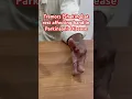 Resting tremors Shaking affecting left hand in a person with Parkinson s disease