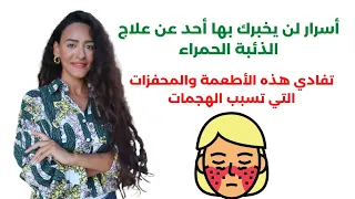 علاج الذئبة الحمراء نهائيا وبدون رجعة نظام كامل من الطبيعة لعلاج مرض الذئبة بدون أدوية 