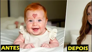 Bebê nasce com coração na testa, e após 18 anos ela está assim.