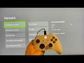 Xbox Series How to Fix Cannot Obtain IP Address Tutorial Network Settings 2025
