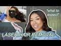 LASER HAIR REMOVAL VLOG underarms brazilian LaserAway